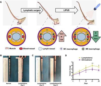 Low-intensity pulsed ultrasound reduces lymphedema by regulating macrophage polarization and enhancing microcirculation